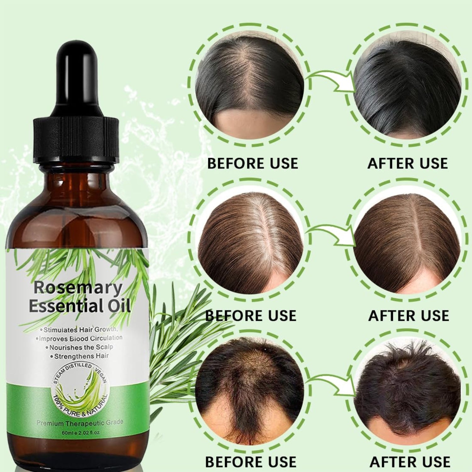 Rosmarinöl 180ml für Haarwachstum Set Hautpflege Natürlich gegen Haarausfall