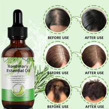 Rosmarinöl 180ml für Haarwachstum Set Hautpflege Natürlich gegen Haarausfall