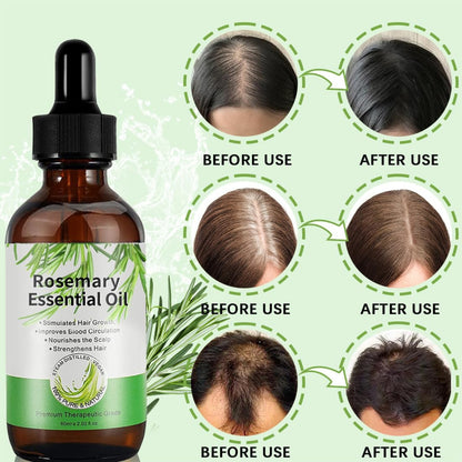 Rosmarinöl 180ml für Haarwachstum Set Hautpflege Natürlich gegen Haarausfall