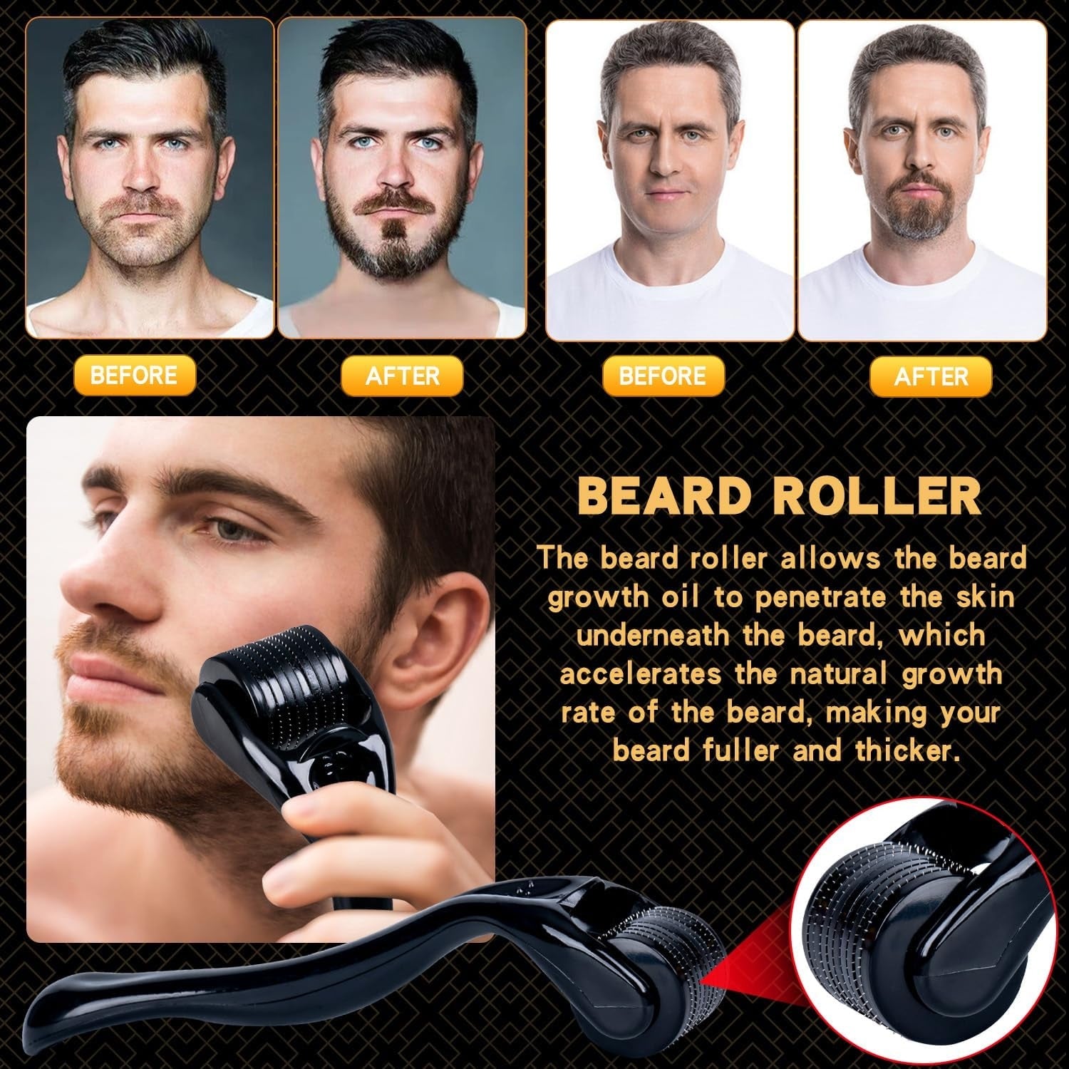 Bartwuchsset mit Bartroller Bartpflegeset Männer 2er Bartöl Shampoo Balsam Kamm