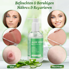 Aloe Vera Gel 100% Rein 280ml Creme für Gesicht Körper Feuchtigkeitsspendend
