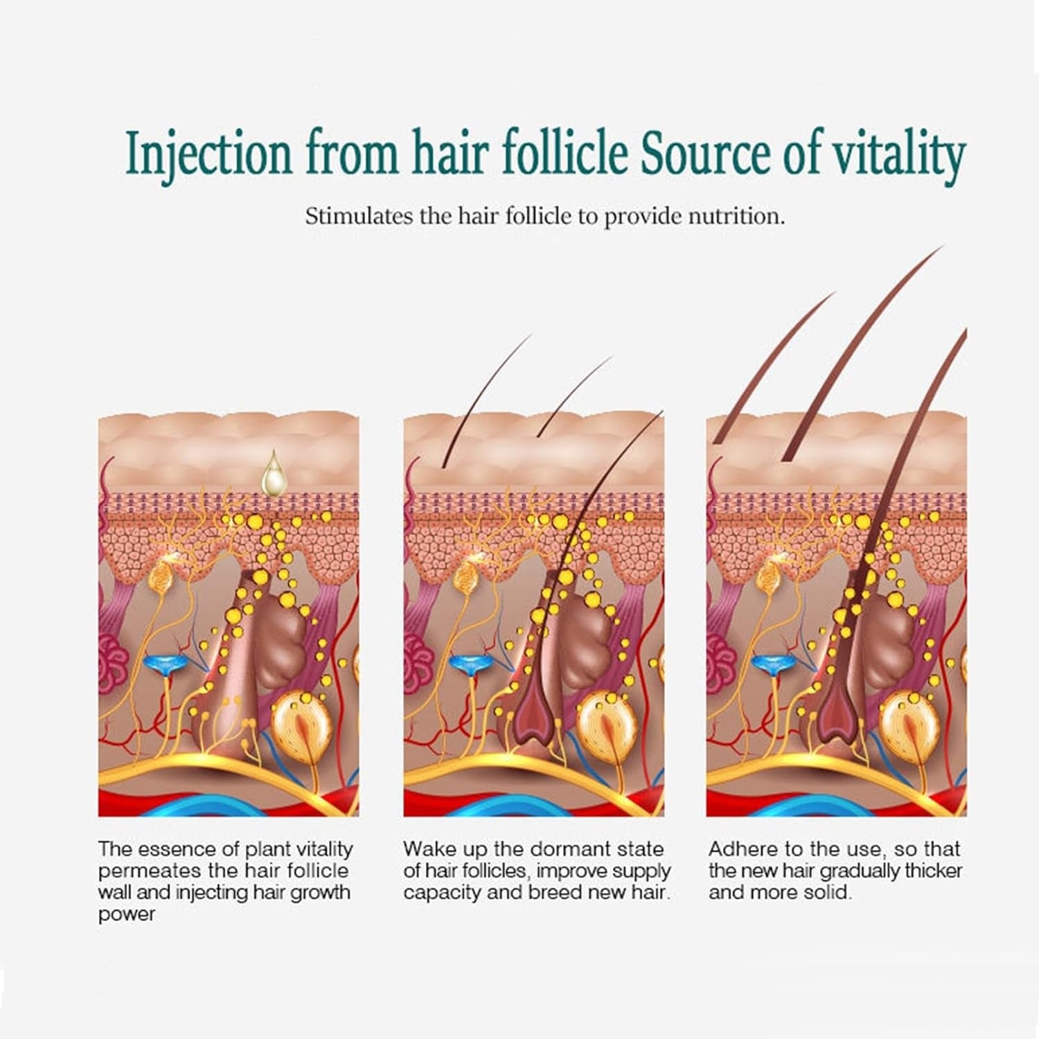 Haarwachstum beschleunigen Dermaroller Set Bartroller mit Ingwer Serum