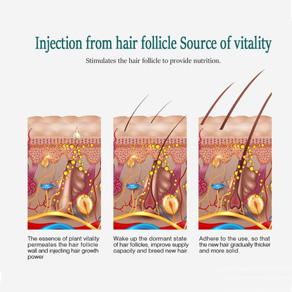 Haarwachstum beschleunigen Dermaroller Set Bartroller mit Ingwer Serum
