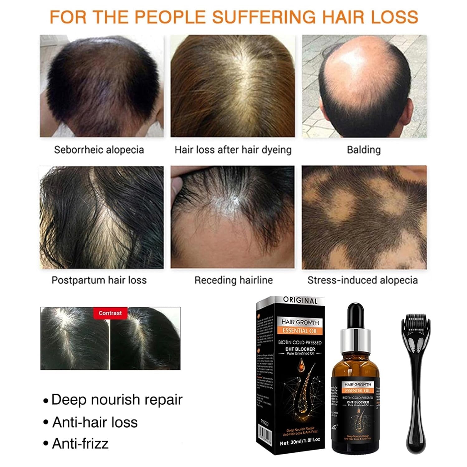 Haarwachstum Serum mit 0.5mm Dermaroller Bartroller Haarwachstum beschleunigen Ingwer Hair Growth Oil Set gegen Haarausfall dichteres Haar