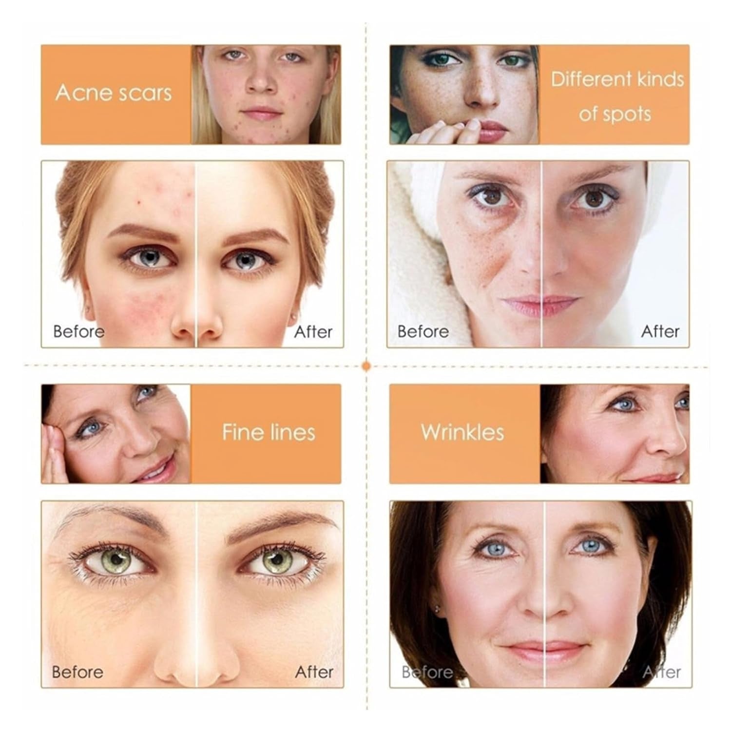 Vitamin C Hautpflege Set für Frauen Teenager-Mädchen Skin Care Set Gesichtswasser Creme Maske Serum 5-tlg Gesichtspflege Set als Geschenk