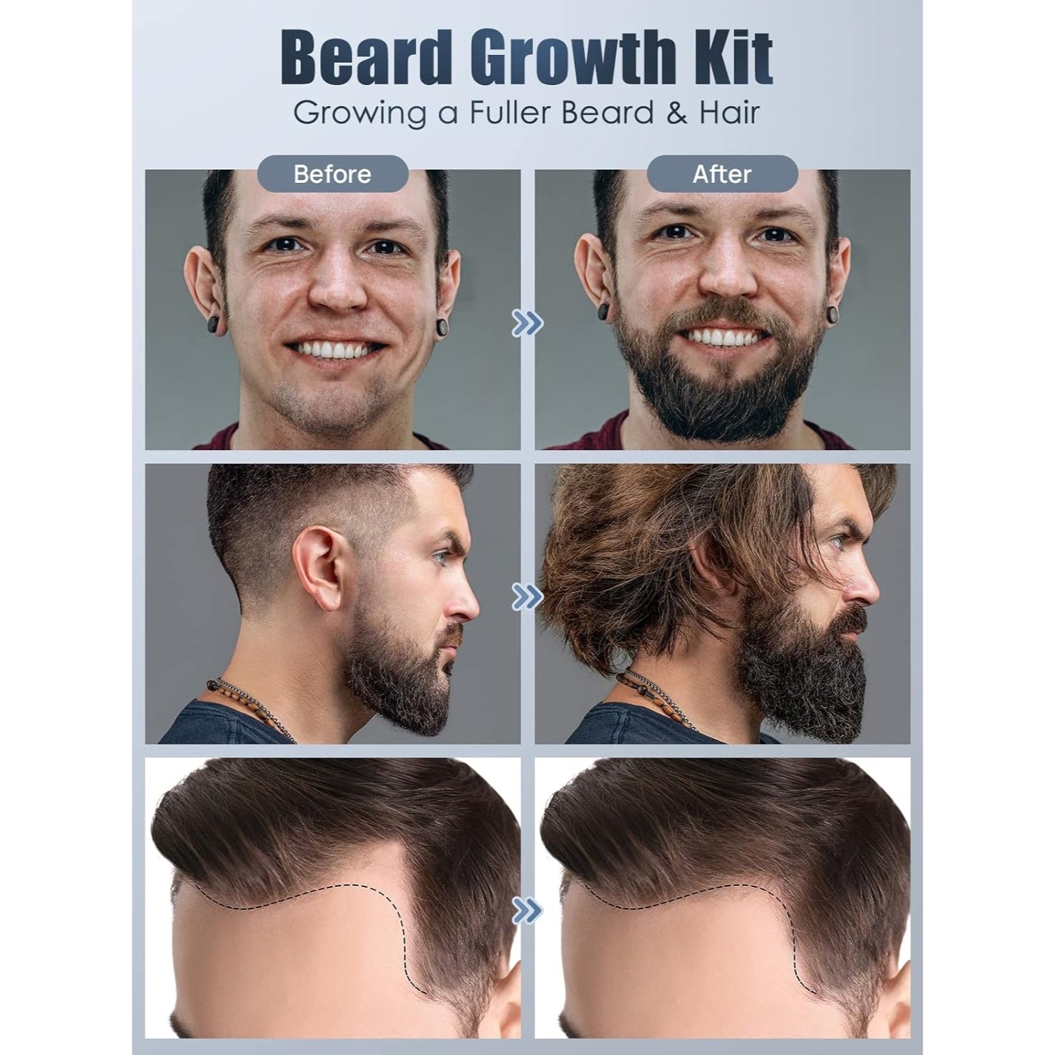 Beard Growth Kit Männer Bartroller Bartwuchs 0,25mm Bartwuchsmittel 100% Natürliche Inhaltsstoffe für schnelleren Bartwachstum Geschenke für Männer