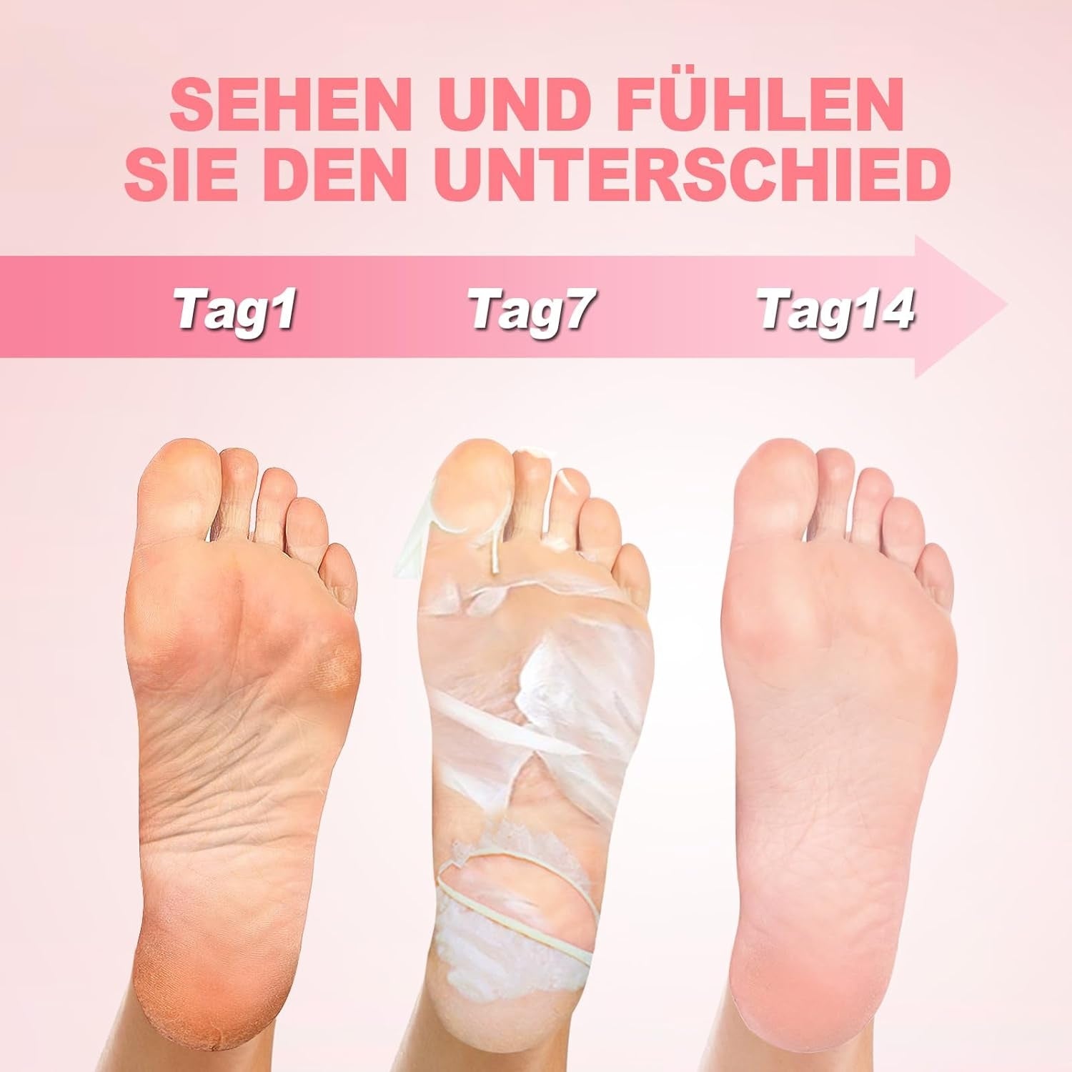 Fußpeeling Maske 3er Pack Milchsäure Feuchtigkeitsspendende Fussmaske Hornhaut Socken Sanfte Fußpflege Entfernung von Hornhaut Repariert Raue Fersen