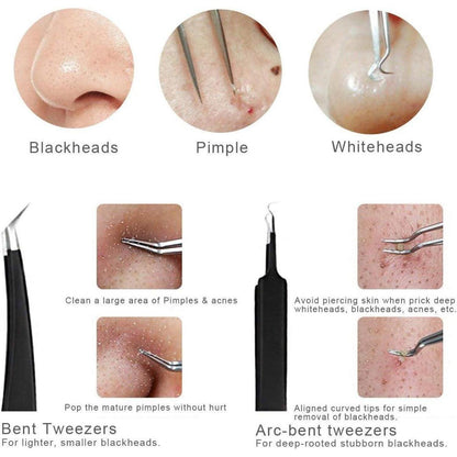 XOOL 10-teiliges Präzisions-Pinzetten