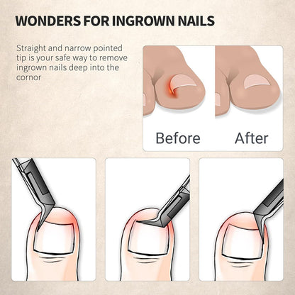 Nagelzange gerade Klinge für eingewachsene Fußnägel und dicke Nägel