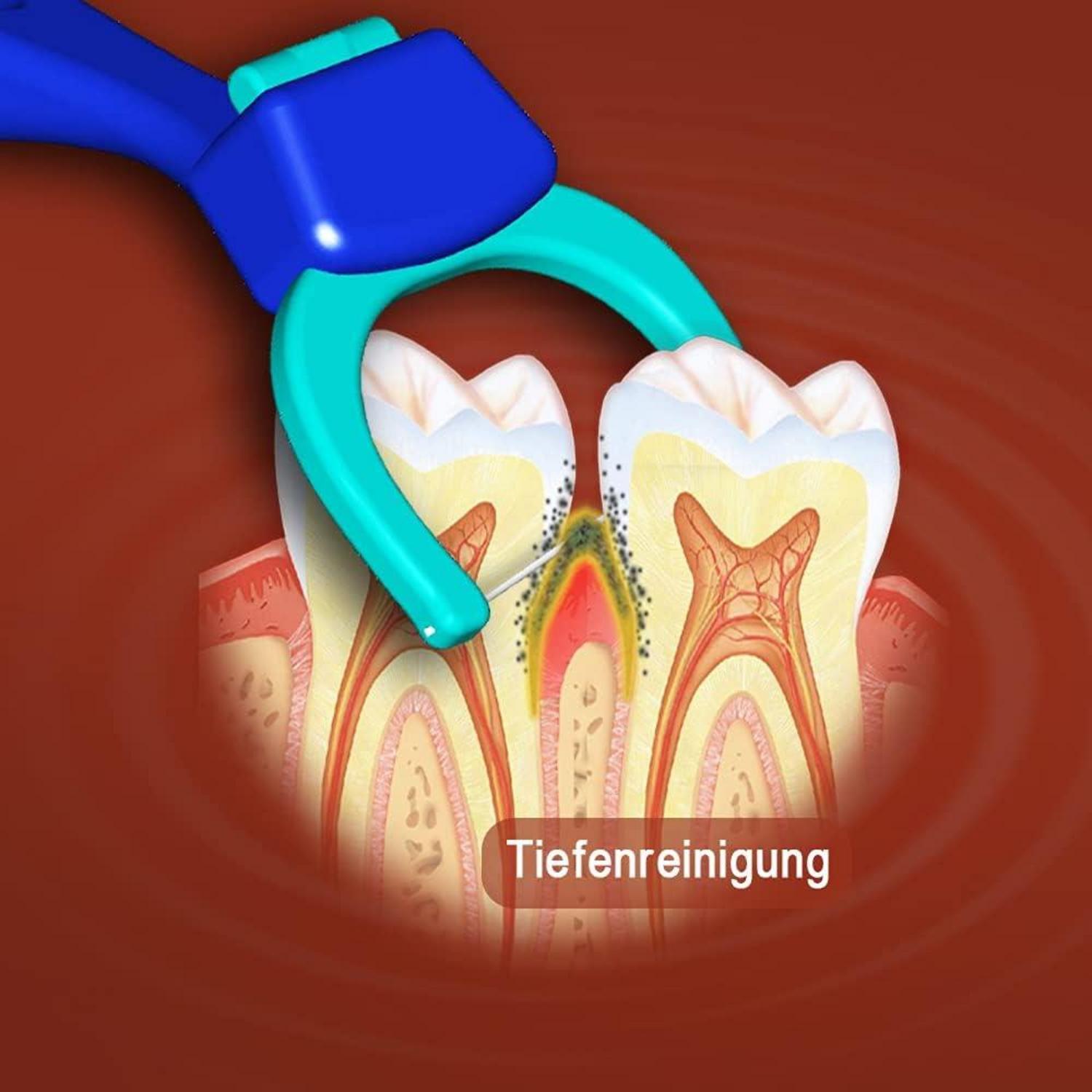 Evolutionäre Zahnseidenhalter Set +100 Aufsteckköpfe