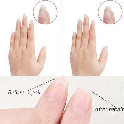 10 Stück Doppelseitige 100/180 Nägelfeilen Nageldateiset Nagelpflege & Styling