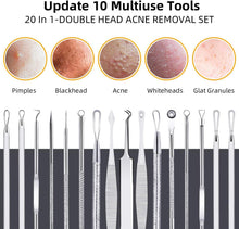 Mitesserentferner Komedonenquetscher Set - 10PCS Blackhead
