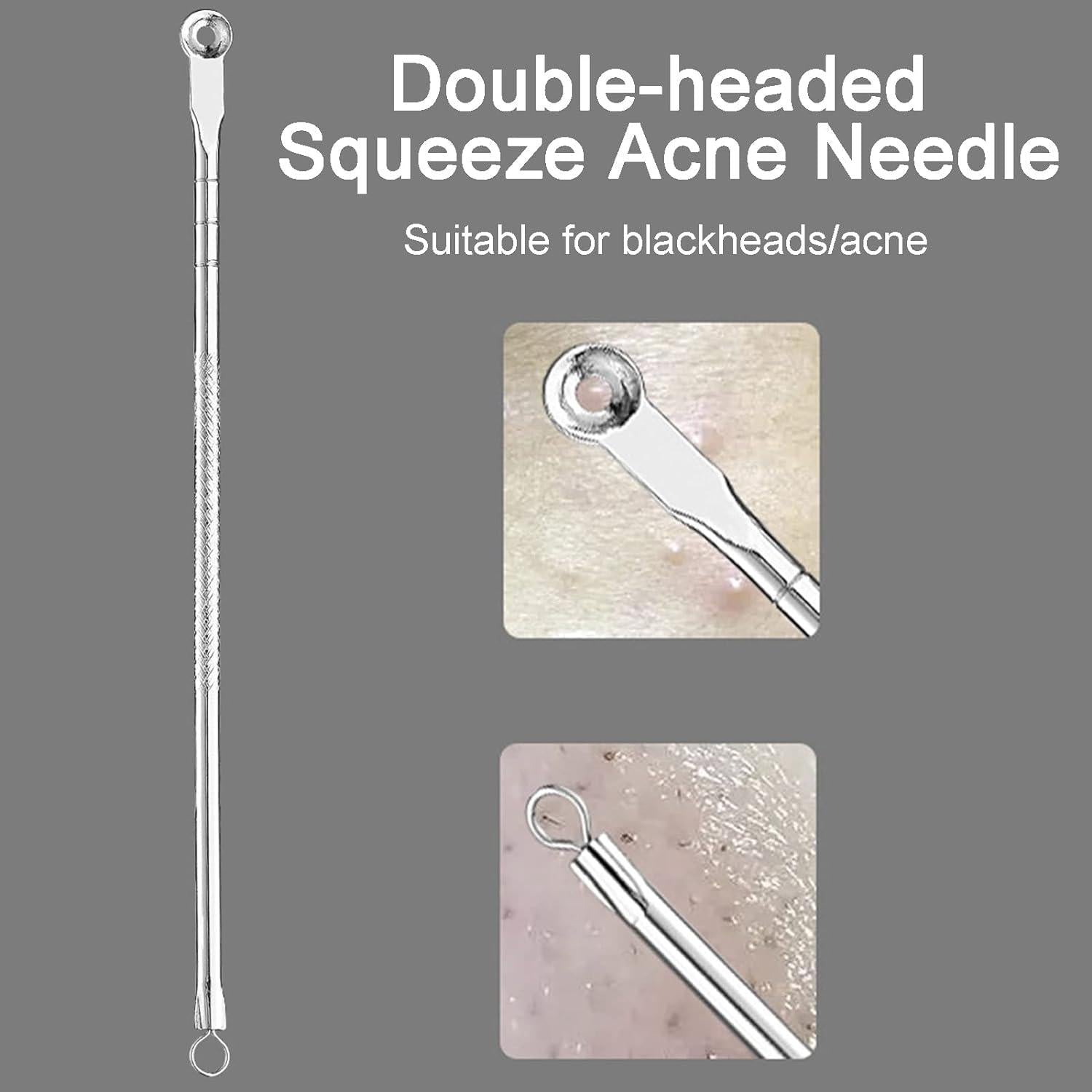 Mitesserentferner Set 5-teilig Akne Blackhead Remover Edelstahl Box