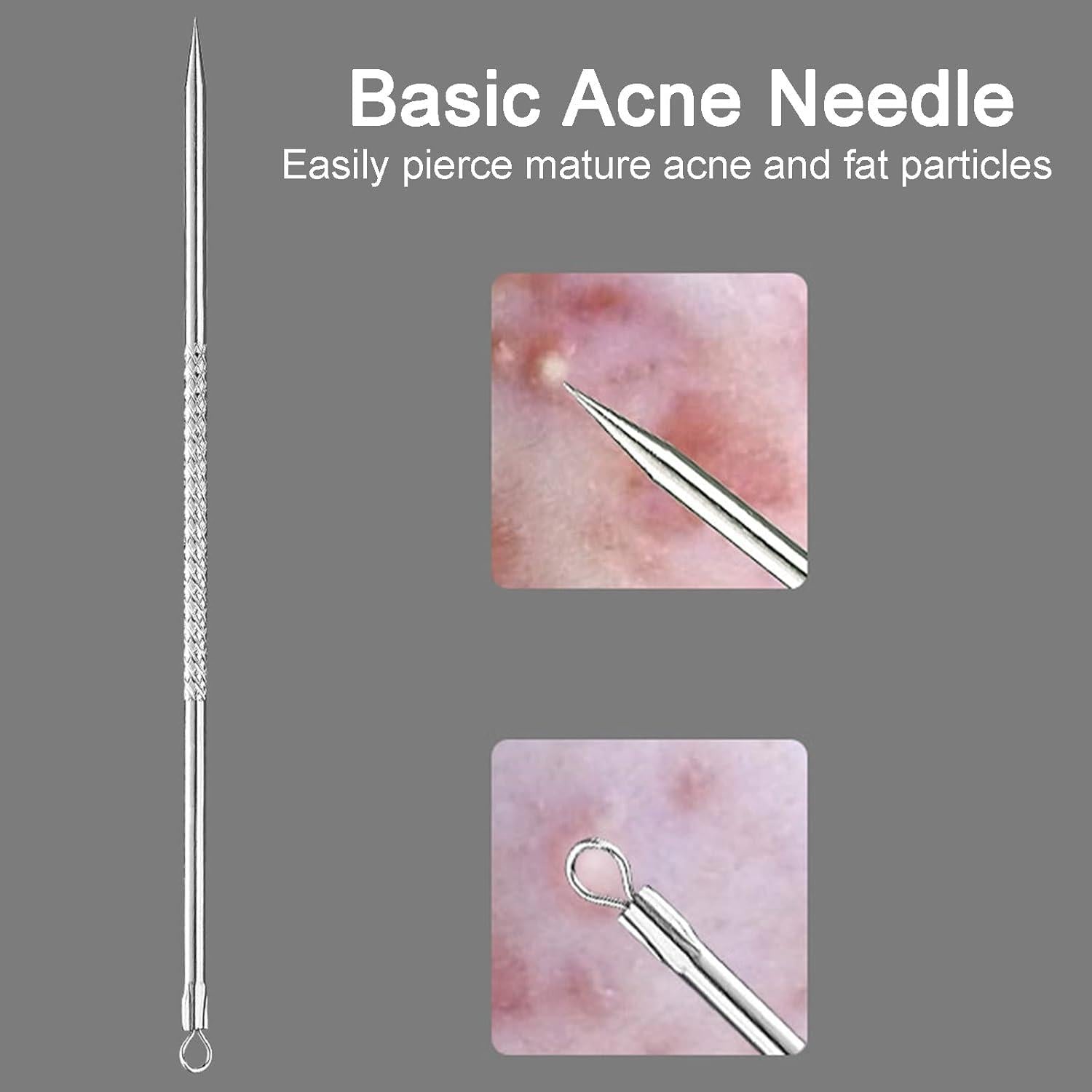 Mitesserentferner Komedonenquetscher Set Blackhead Remover Edelstahl Hygienisch