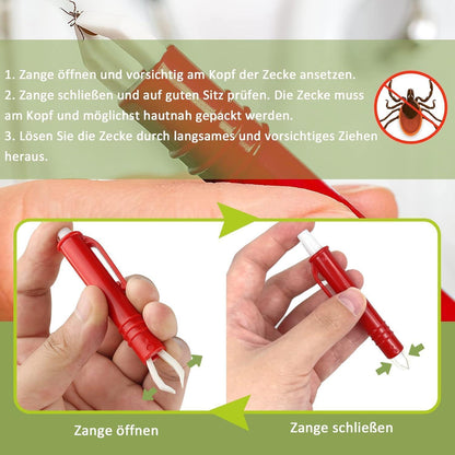 Zeckenzange für Hunde Katze Mensch 2er Set Zeckenpinzetten