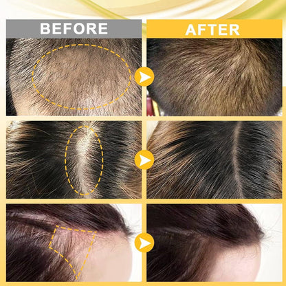 Dermaroller Haaröl Bartroller Set 30ML gegen Haarausfall