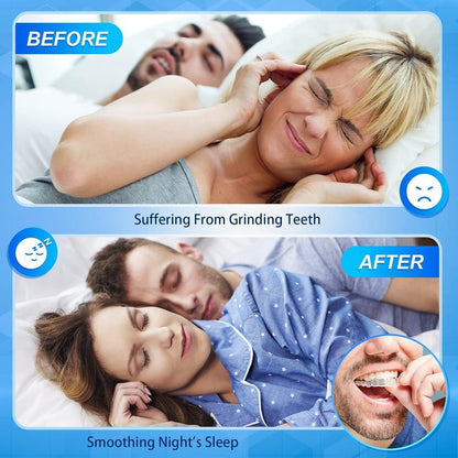 Schnarchschiene 4er Set Anti-Zähneknirschen mit Box