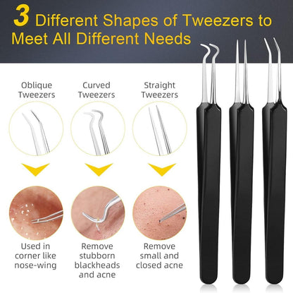Mitesserentferner Set 15 Stücke Hochwertiger Blackhead