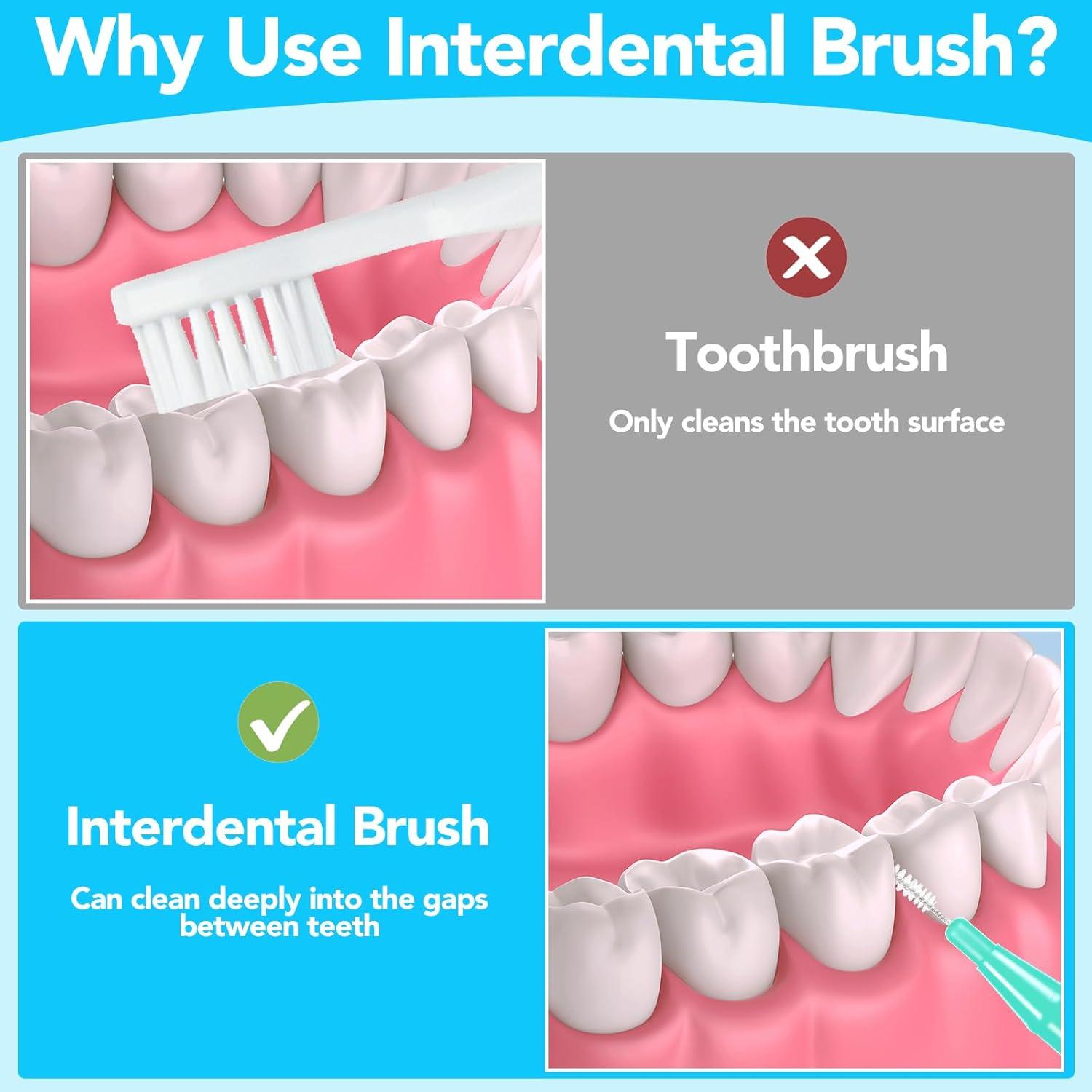 20 Stück Interdentalbürsten Zahnzwischenraumbürsten Reinigung