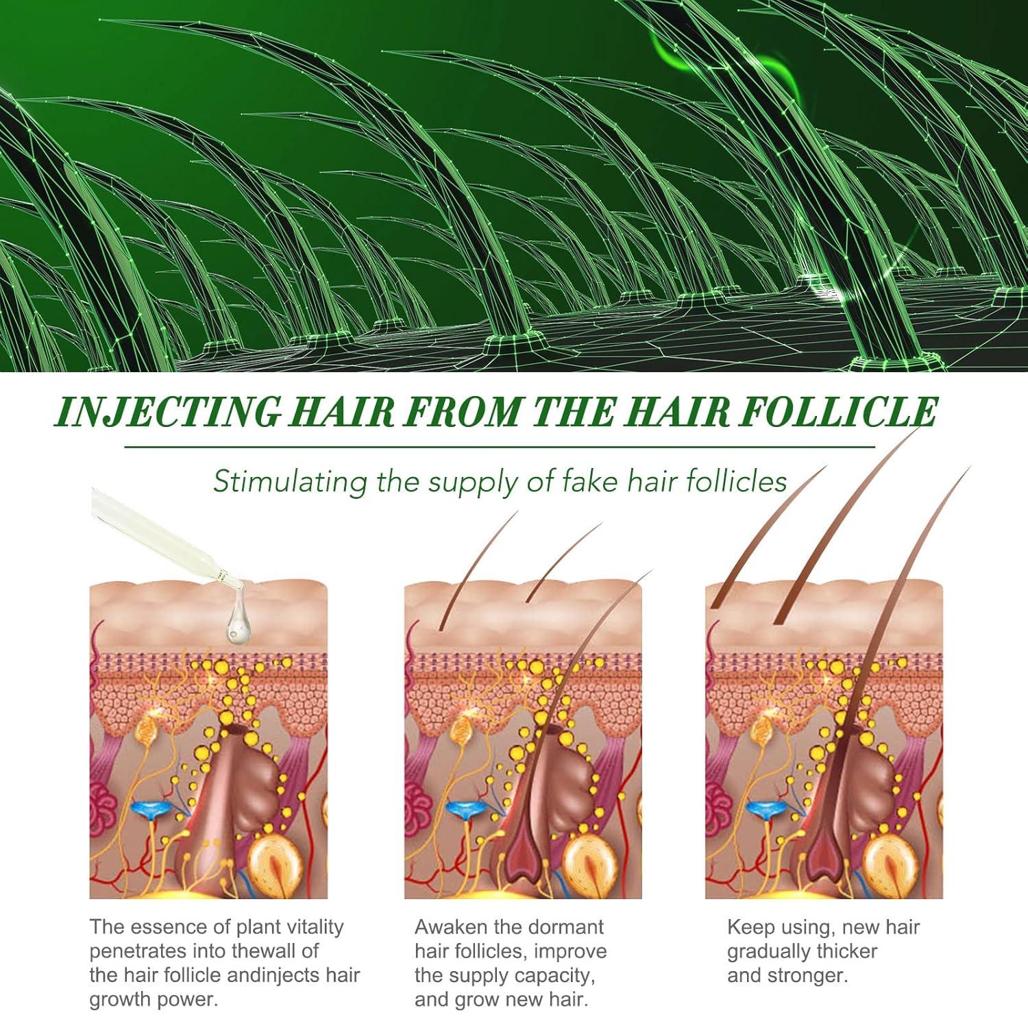 Rosmarinöl Haare 120ML Ätherisches Rosemary Oil for Hair