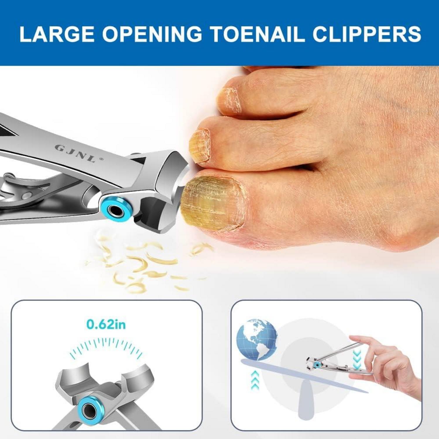 Professionelles Fußnagelzangen-Set für dicke Nägel - Scharfer Nagelknipser mit Nagelfang