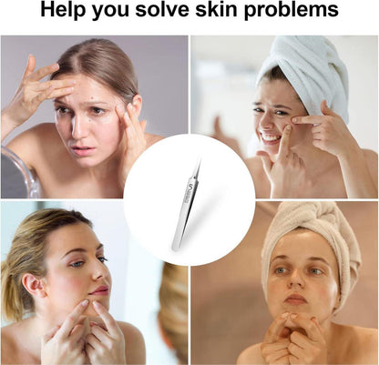 Edelstahl Pinzette Mitesser Entferner Präzisions Splitter Extraktor