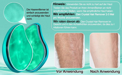 Nano Kristall-Haarentfernung ohne Schmerzen - Schmerzloser Epilierer