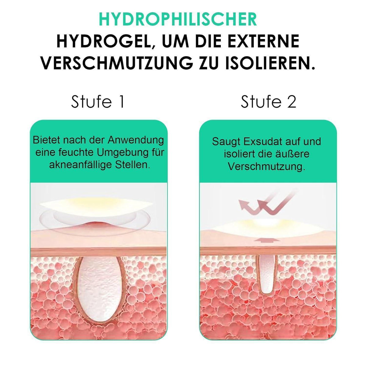 Hydrokolloid Pickel Patches – 264 Stück – Unsichtbar & Wasserfest