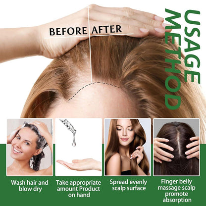 Rosmarinöl 100% 180ml für Haarwachstum Set gegen Haarausfall