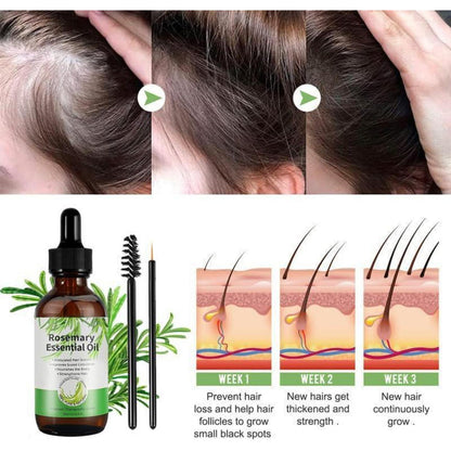 Rosmarinöl 100% 180ml für Haarwachstum Set gegen Haarausfall