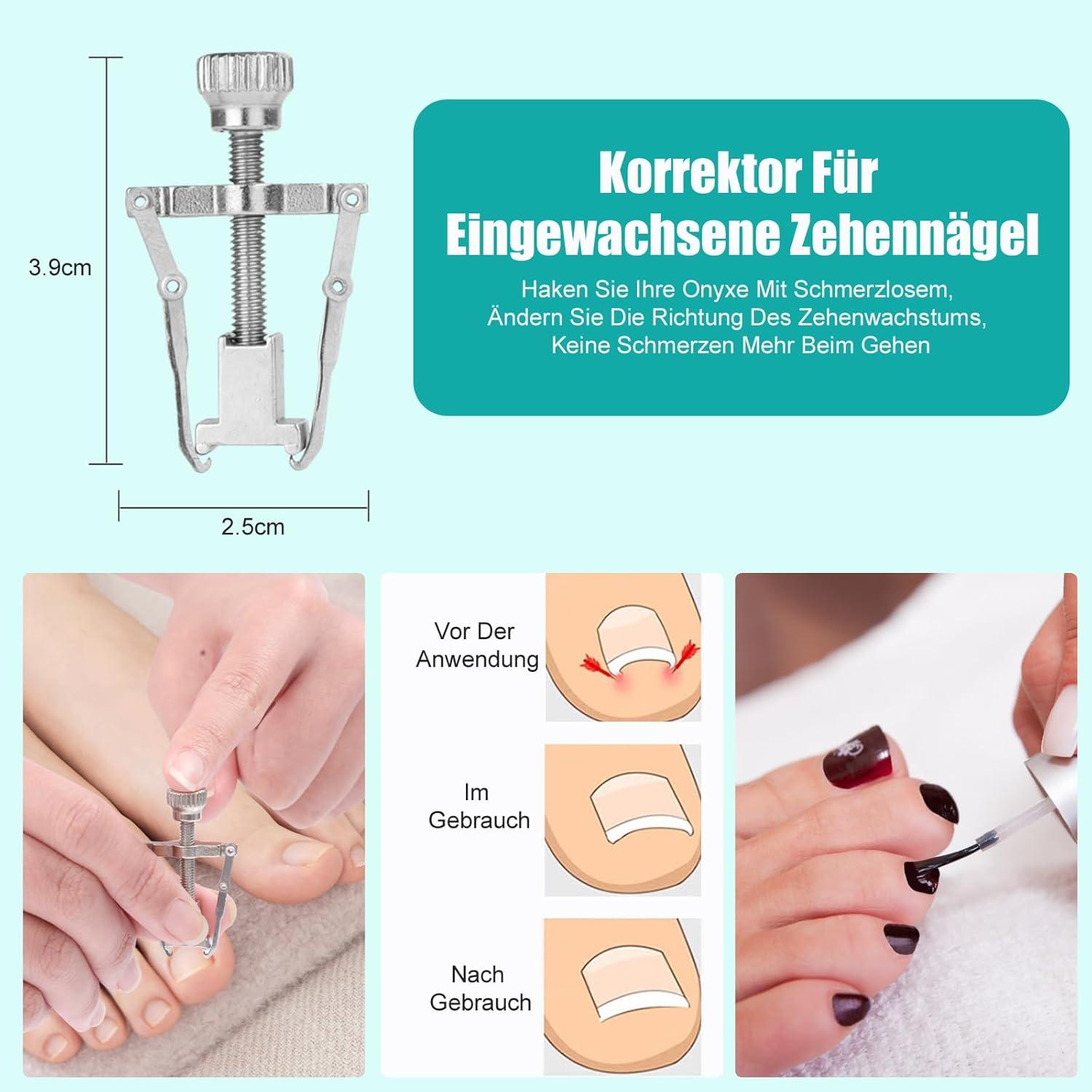 Fußnagelknipser Set Nagelzange für dicke eingewachsene Nägel 8-tlg. Maniküre