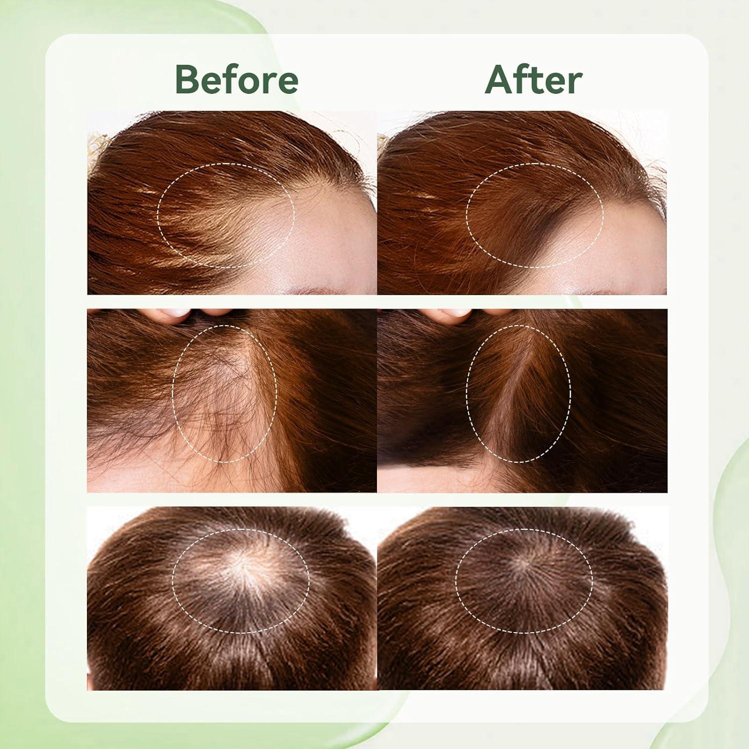 120ML Rosmarinöl Haarpflege-Set mit Applikator und Massagebürste
