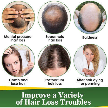 Rosmarinöl Haare 100% Natürlich 60ML Haaröl Rosemary Oil