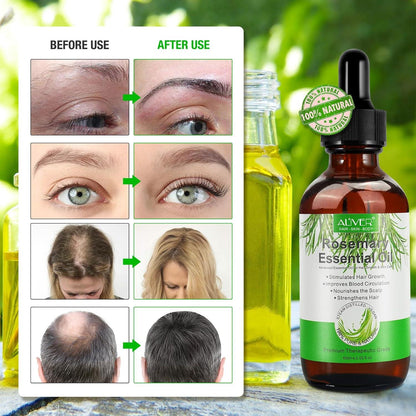 Rosmarinöl Haarwachstum 60ml mit Kopfhautmassagegerät
