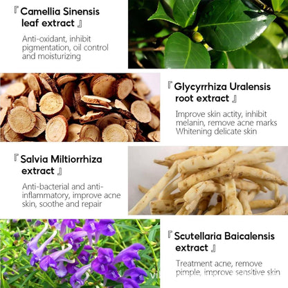 Herbal Anti-Akne Serum und Creme Set Natürliche Pflege