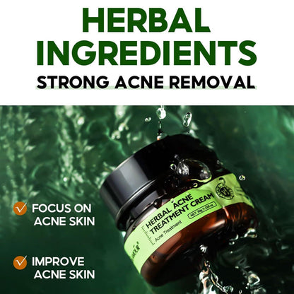 Herbal Anti-Akne Serum und Creme Set Natürliche Pflege