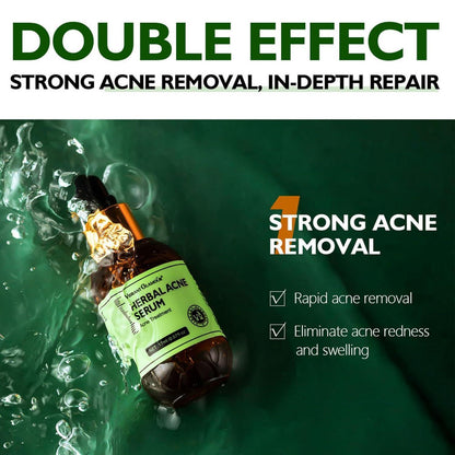 Herbal Anti-Akne Serum und Creme Set Natürliche Pflege