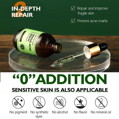 Herbal Anti-Akne Serum und Creme Set Natürliche Pflege