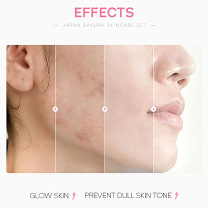 Sakura 5tlg Hautpflege korean skincare Geschenke Frauen