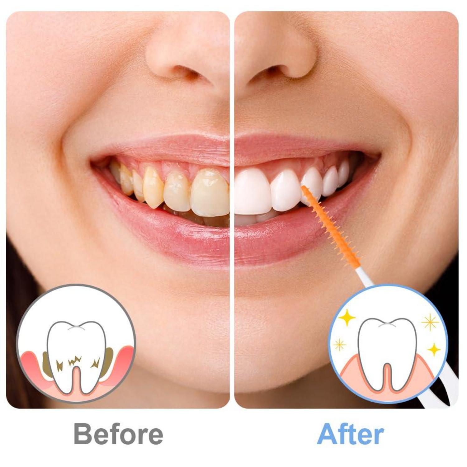 Interdentalbürsten 220 Stück Silikon Zahnzwischenraumbürsten Dental Stick