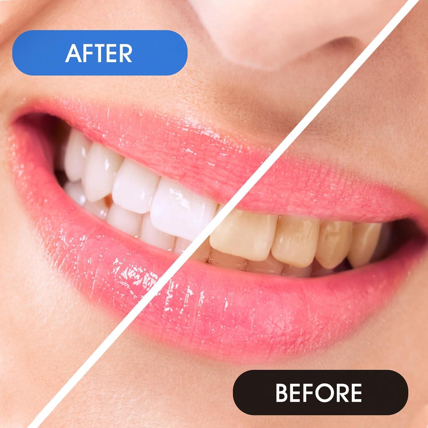 25x Prasacco Interdentalbürsten 0,7mm L-Form Zahnzwischenraum Blau