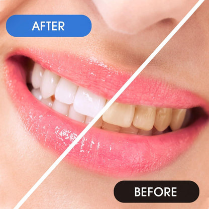 25x Prasacco Interdentalbürsten 0,7mm L-Form Zahnzwischenraum Blau