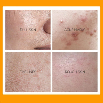 Vitamin C Hautpflege Set Anti-Aging 4tlg