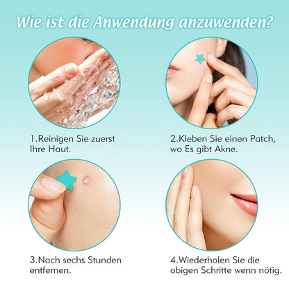 Pickel Patches mit Teebaumöl & Salicylsäure – 240 Stück