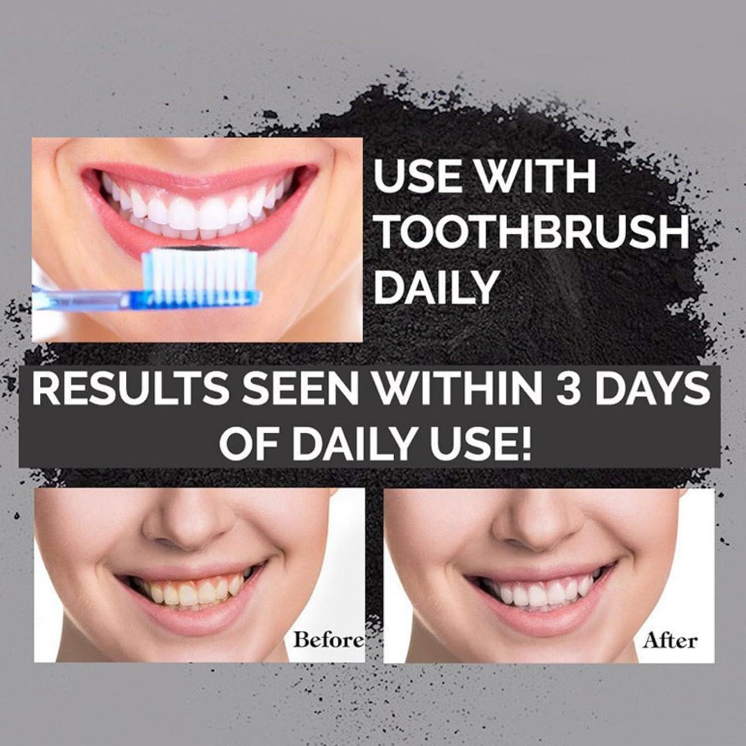 Aktivkohle Zahnaufhellung Pulver Weißere Zähne Zahnweiß Charcoal Whitening