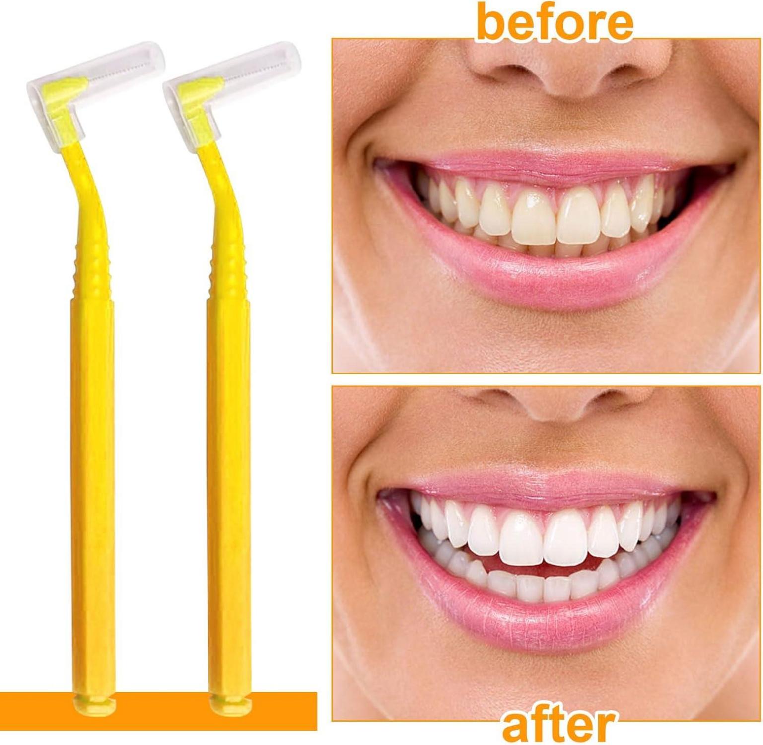 Zahnzwischenraumbürsten Gelb 30 Stück Anti-Rutsch-Griff Dental_hochwertige