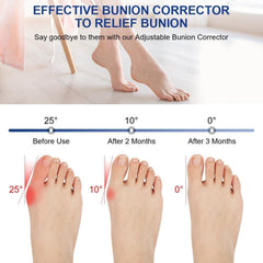 Hallux Valgus Korrektur Set mit Zehenspreizern - Bunion Bandage