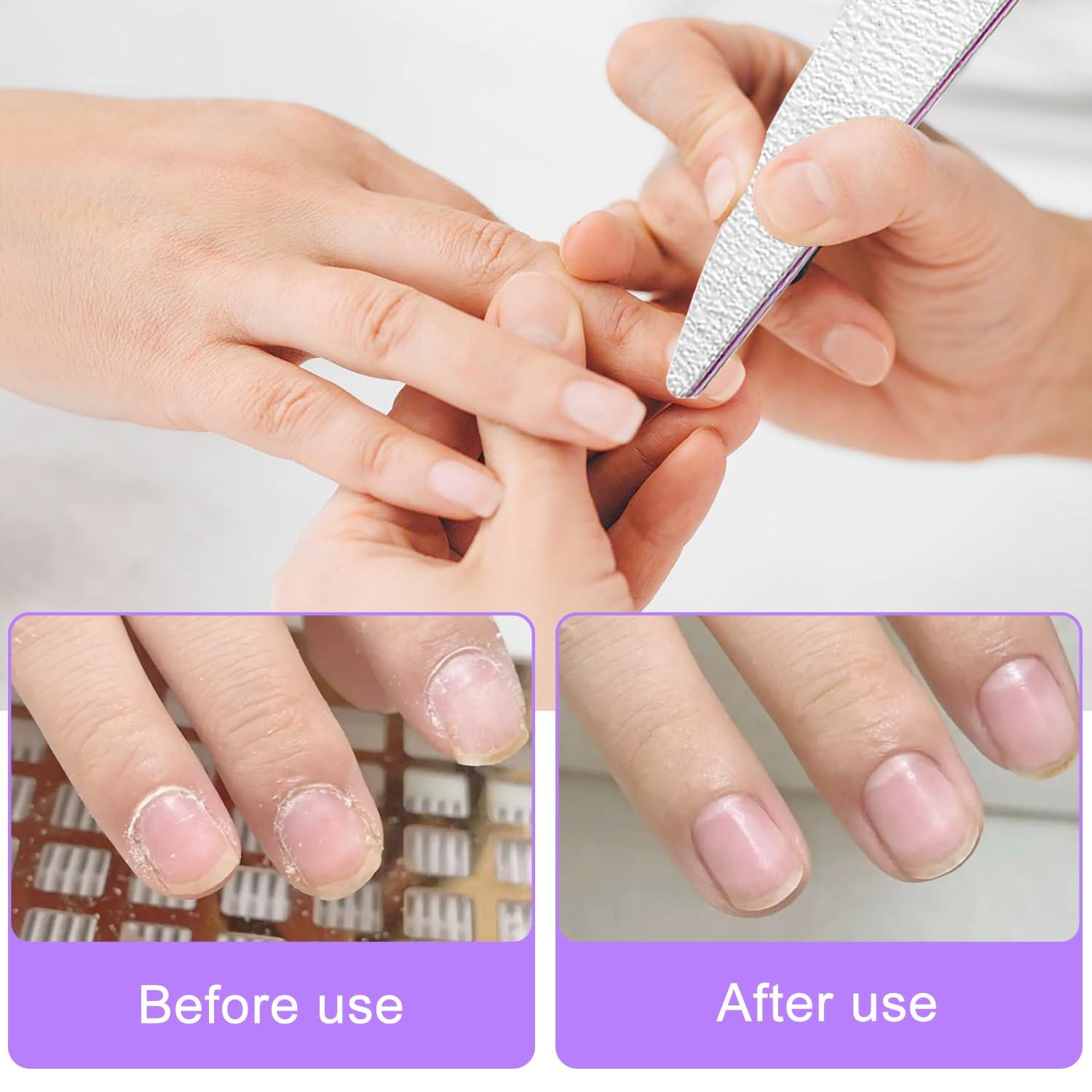 6er Pack Nagelfeile 100/180 Körnung für Gelnägelstudio & Zuhause