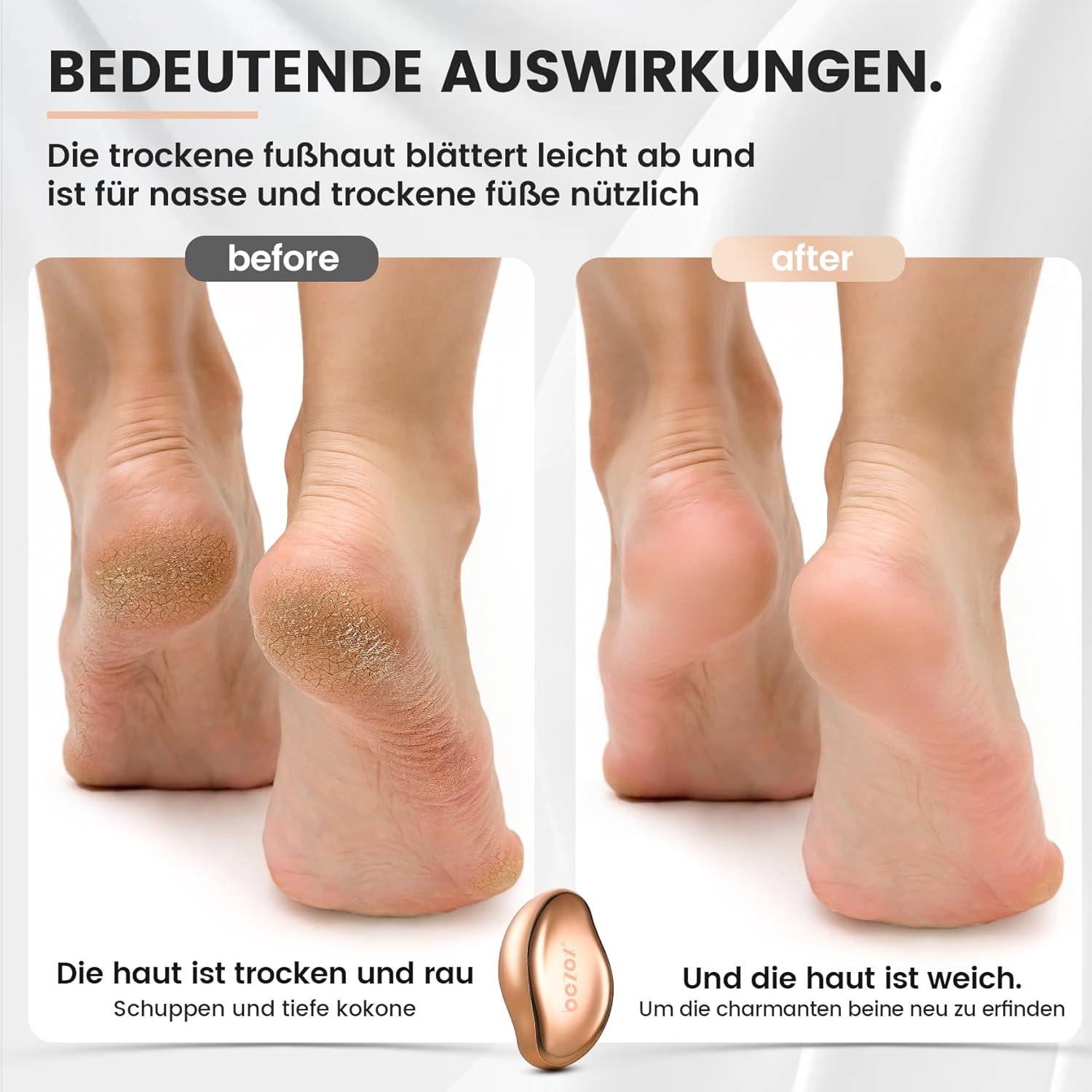 2in1 Nano Glas Hornhautentferner Pediküre Premium Feile