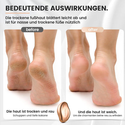 2in1 Nano Glas Hornhautentferner Pediküre Premium Feile